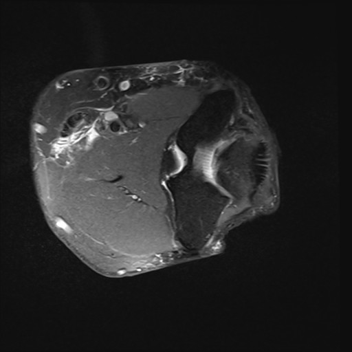 Click on the Serie image to view the images of Wieszt, Gnter